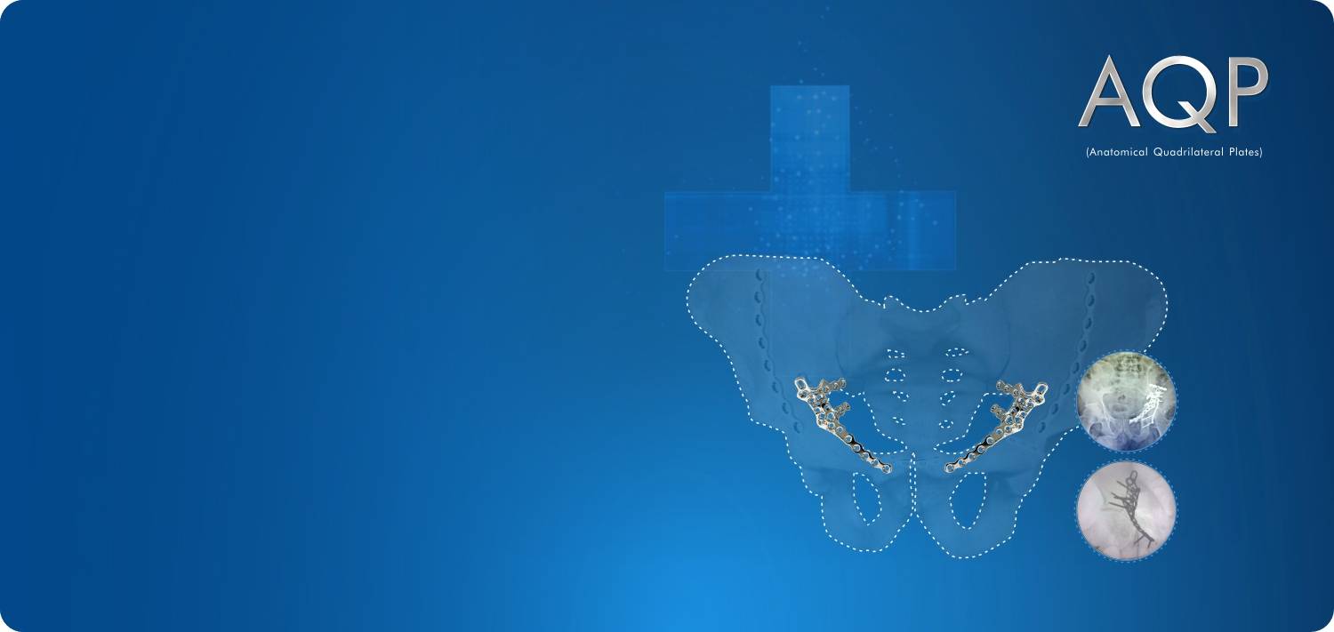 Anatomical Quadrilateral Plate System - Orthopedic Implants by GiaPlus